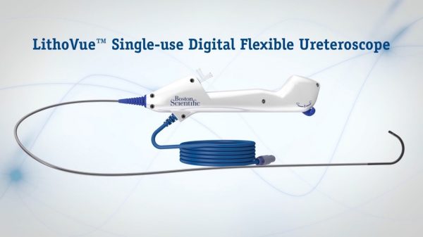 Features & Benefits | LithoVue™ Single-Use Digital Flexible ...